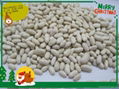 white kidney bean 1