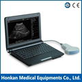 Portable ultrasound machine