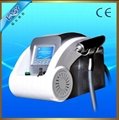 q-switched nd yag laser for tattoo