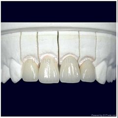  Dental PFM/Porcelain fused to metal crown and bridge(Cobalt-Chrome alloy)