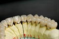  Dental PFM/Porcelain fused to metal crown and bridge(Cobalt-Chrome alloy) 3