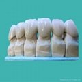  Dental PFM/Porcelain fused to metal crown and bridge(Cobalt-Chrome alloy) 4
