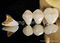 Dental Captak teeth restoration / Precious high noble porcelain metal crown 3