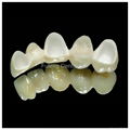 Dental CAD/CAM Wieland & Lava & Cercon Zirconia all ceramic  aesthetic crown 