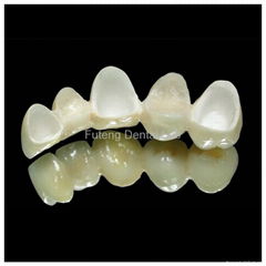 Dental CAD/CAM Wieland & Lava & Cercon Zirconia all ceramic  aesthetic crown 
