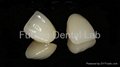Dental CAD/CAM Wieland & Lava & Cercon Zirconia all ceramic  aesthetic crown  4