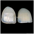 Dental E.max / CAD-CAM Zirconia All