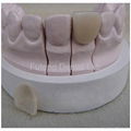 Dental E.max / CAD-CAM Zirconia All Ceramic aesthetic Veneers  3