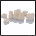 Dental E.max / CAD-CAM Zirconia All Ceramic aesthetic Veneers  4