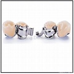 Dental Precision Attachment removable with high functions 