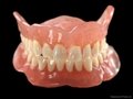 Dental Removable Partial Acrylic Resin Denture 2