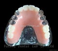 Dental Removable Partial Acrylic Resin Denture 1