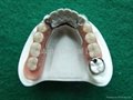 Dental Removable Partial Acrylic Resin Denture 3