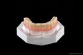 Dental Removable Partial Acrylic Resin Denture 4