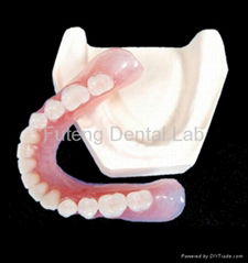 Dental Removable partial Flexible