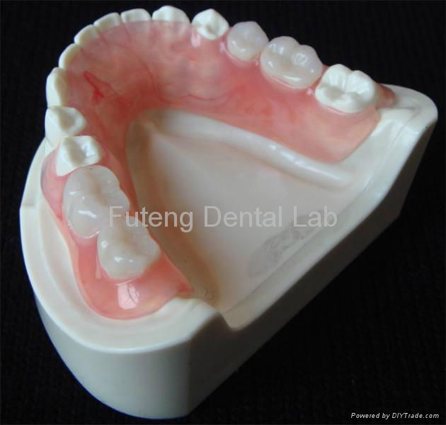 Dental Removable partial Flexible acrylic Denture Base  2