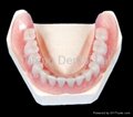 Dental Removable partial Flexible acrylic Denture Base  3