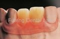 Dental Removable partial Flexible acrylic Denture Base  4