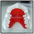 Dental Removable Orthodontic Begg