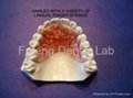 Dental Orthodontic Halwey Retainers  3