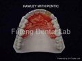 Dental Orthodontic Halwey Retainers  4
