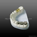 Dental Full cast NP/ Gold crown and