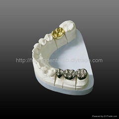 Dental Full cast NP/ Gold crown and bridge(FCC denture restoration)