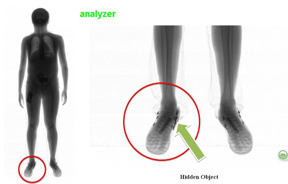 Body scanner 2