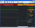 Multi-parameter Touch-screen Monitor 2
