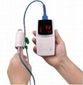 Palm Pulse Oximeter 1