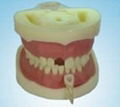 Root Canal Filling Model