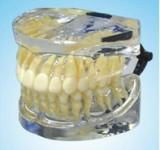 Complete Transparent Standard Adult Teeth Model