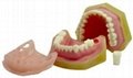Standard Dentition Model Removable