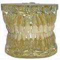 Complete Transparent Tooth Extraction Model