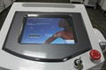 diode laser hair removal machine 5