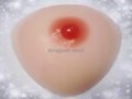 triangle silicone breast prosthesis