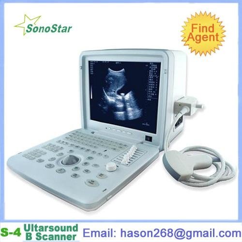  SS-4 Ultrasound Diagnosis B Scanner