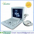  SS-4 Ultrasound Diagnosis B Scanner 1