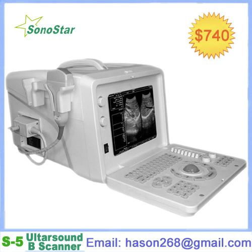  SS-5 Ultrasound Imaging Systems