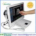 UTouch-8 Touch Screen LCD Ultrasound Scanner 1