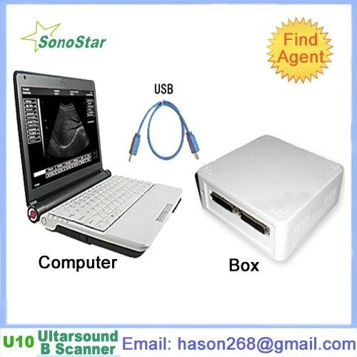  UBox-10 Ultrasound B Scanner Box(