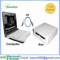  UBox-10 Ultrasound B Scanner Box( 1