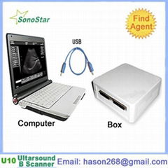  UBox-10 Ultrasound B Scanner Box(