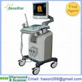 SS-500 Ultrasound B scanne