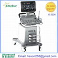 SS-2200 Color Doppler System