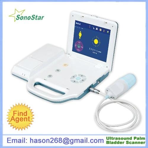 SB-1Plus PBS Ultrasound Palm Bladder Scanner