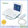 SB-1Plus PBS Ultrasound Palm Bladder Scanner 1