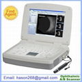 SAB-500 Ophthalmic A/B Scanner