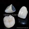 dental PFM crown 1