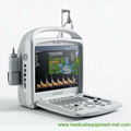 Portable color doppler ultrasound